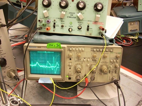 Electrical impulses being displayed on the oscillator.