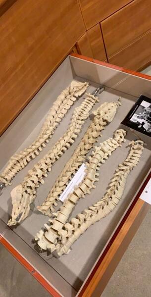a drawer of human spines